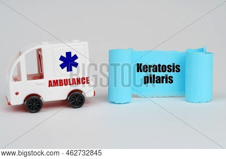 Medical Concept. On A White Surface, An Ambulance And A Blue Paper Sign With The Inscription - Kerat
