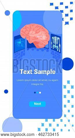 Radiologist Examining Mri Scan Of Patient Brain On Smartphone Screen Health Care Medical Treatment C