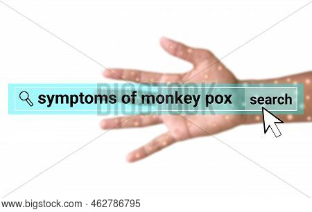 Monkey Pox Search On Blur Infected Hand. Illustration For Awareness About Monkey Pox Disease.
