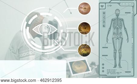 Blurry Close Up A Head Of The Patient Fixed In Tomography Optical Coherence (oct) Equipment And View