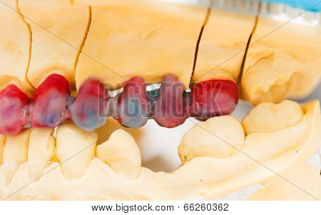 Part Of A Wax Model