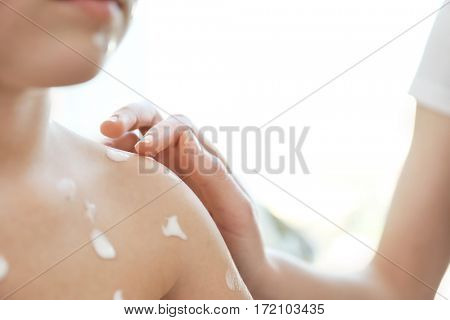 Female hand applying cream onto skin of child ill with chickenpox, closeup