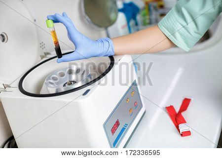 Plasmolifting. Preparation of blood for injections. cosmetologist puts tube of blood in centrifuge for separation processing.