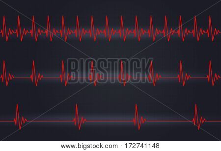 Fast Normal Slow Heartbeat Illustration