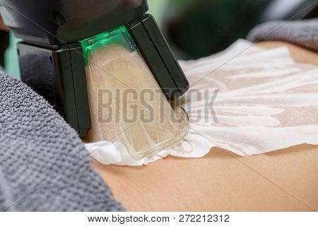Woman Getting Cryolipolysis Fat Treatment Procedure In Professional Cosmetic Cabinet Or Spa Center