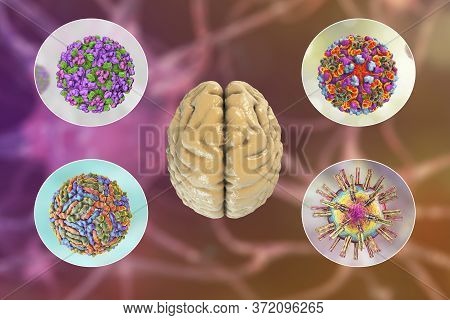 Brain Infections, Microorganisms That Cause Encephalitis And Meningitis