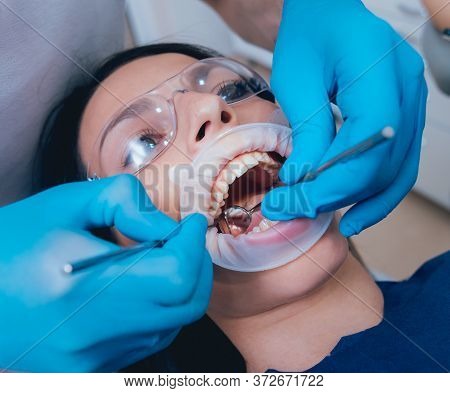 Dental Treatment With Expander. Modern Medical Technology