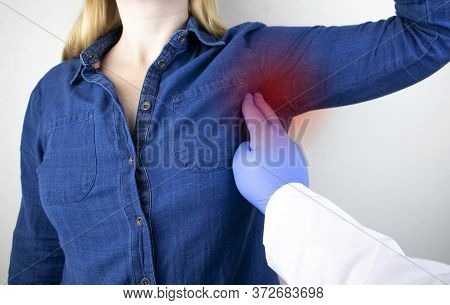 A Woman Suffers From Pain In The Armpit. Sweating, Unpleasant Odor, Redness, Tooth And Inflammation 