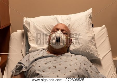 Old Bald Man In A Respirator In A Hospital Bed Asleep On A Pillow, Coronavirus, Cancer, Chemotherapy