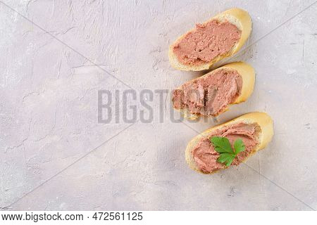Homemade Chicken Liver Pate On Fresh French White Wheat Baguette Slices On Grey Background, Copy Spa