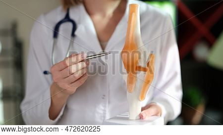 Rheumatologist Points To Anatomical Model Of Human Knee Joint. Doctor Recommendation And Healthcare 