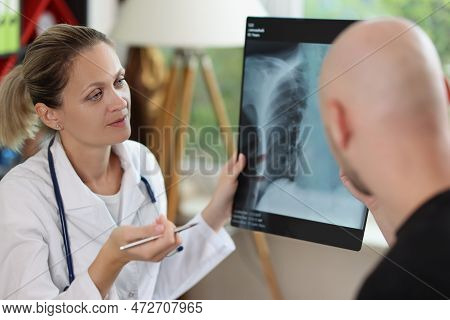 Female Doctor Holding X-ray Image And Pen In Hands And Speaking With Male Patient. Roentgenologist S