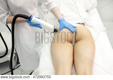 Fractional Resurfacing Of The Buttocks Procedure, Process Of Depilation And Hair Removal, Skin Care