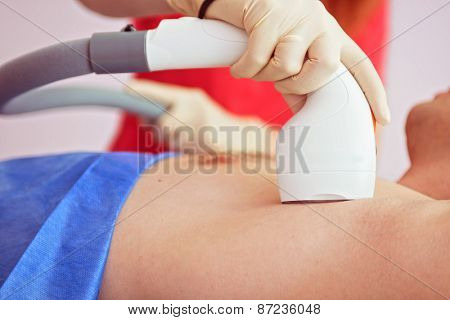 man receiving laser epilation at armpit on beauty center