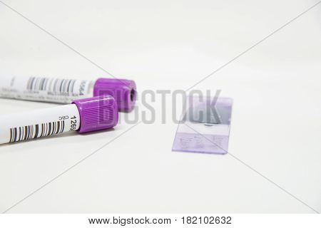 Test tube CBC on white tone in laboratory