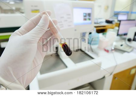 Clotted Blood  With Serum In Tes Tube  Laboratory Background.