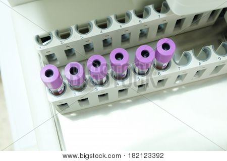 Test Tube Cbc Lab
