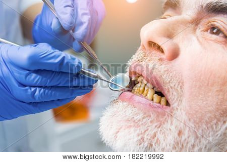 Dentist examining patient, close up. Elderly male with bad teeth. Tobacco use influences dental health.