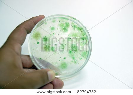 Colony of blue green algae in culture medium plate Microbiology.