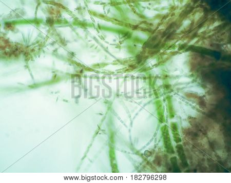 Filamentous algae are single algae cells that form long visible chains threads or filaments.