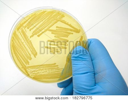 Colony of bacteria in culture medium plate Microbiology.