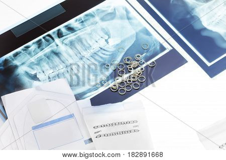 Orthodontic rings for braces and wires on top of closeup teeth xray