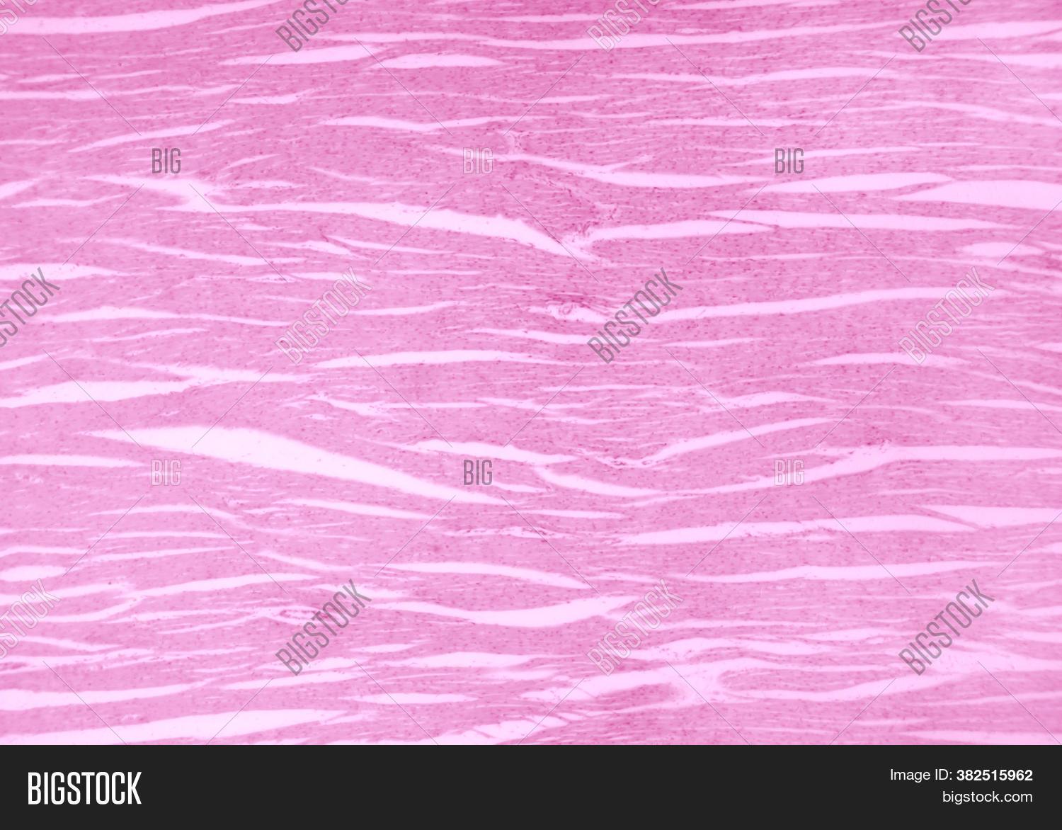 Cardiac Muscle Section Image & Photo (Free Trial) | Bigstock