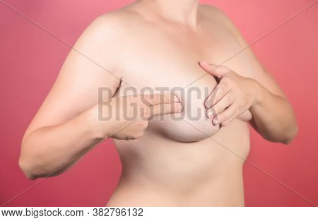 30 Year Old Topless Woman Doing Breast Self Exam Bse. Check For Breast Changes, Possible Lumps, Dist