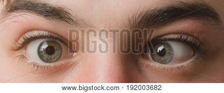 Eyes With Squinted Look