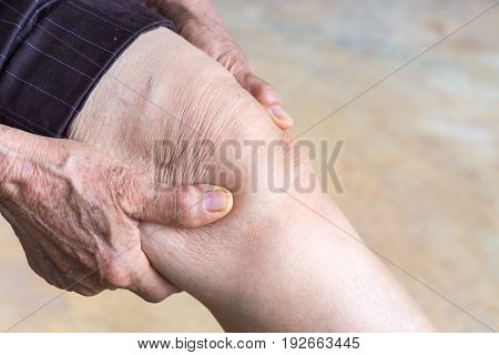 legs older person, Knee Pain, elder osteoarthritis