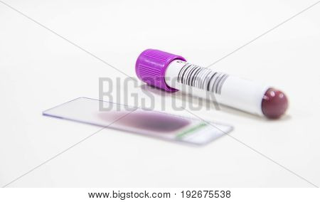 Tube CBC test laboratory on white background.