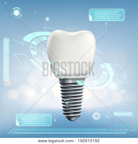 Human dental implant. Futuristic infographics of the tooth. Stock vector illustration.