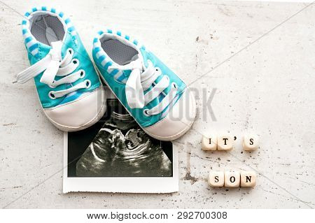 Blue Baby Booties With A Picture Of Ultrasound For 20 Weeks On A Light Background. Inscription Its S