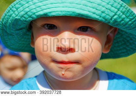 Portrait Of A Child With A Runny Nose