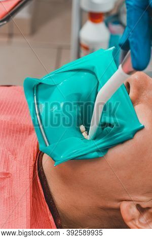 The Dentist Installs A Rubber Dam, Sterile Dental Treatment, Modern Equipment In Dentistry.