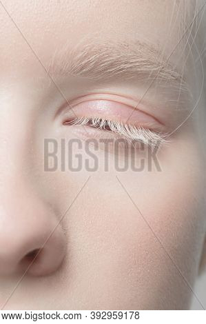 Nose And Eyelid. Close Up Portrait Of Beautiful Albino Female Model. Parts Of Face And Body. Beauty,