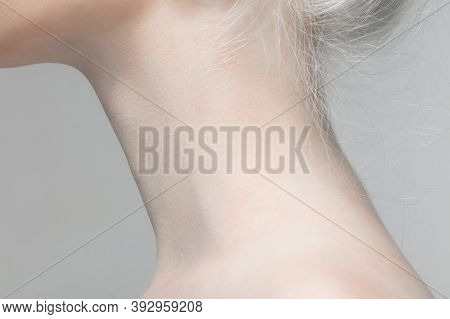 Neck. Close Up Portrait Of Beautiful Albino Female Model. Parts Of Face And Body. Beauty, Fashion, S