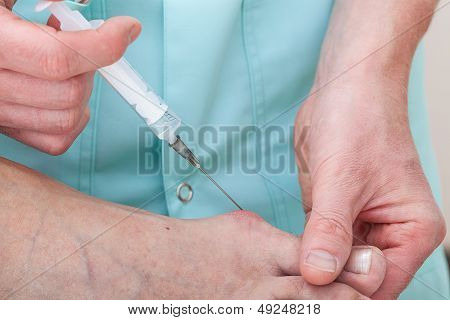 Painkiller Injection