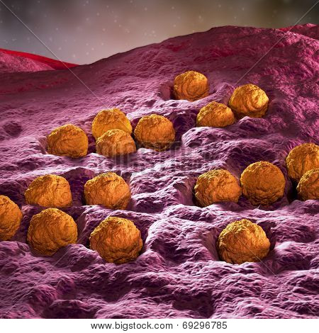 Rubella - German measles