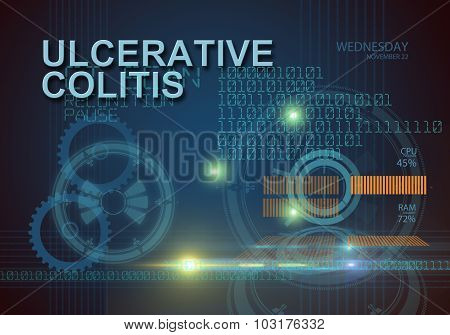 Ulcerative Colitis