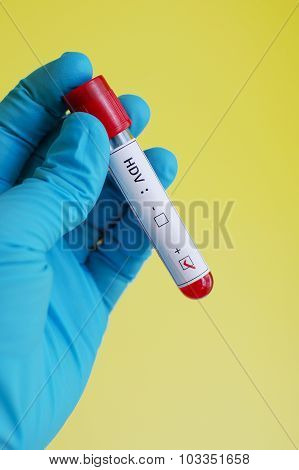 Hepatitis D virus (HDV)