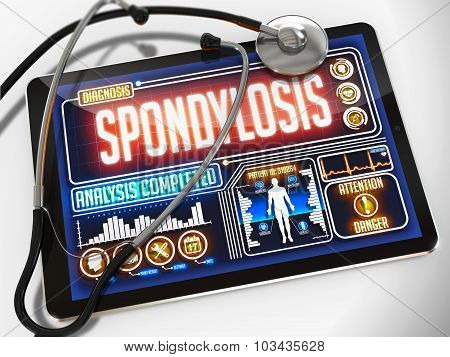 Spondylosis on the Display of Medical Tablet.