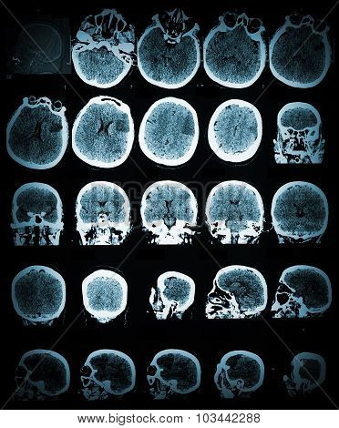 Healthcare And Medical Wallpaper With The Ct Scann image