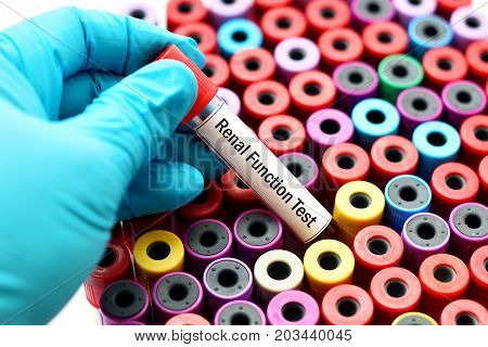 Test tube with blood sample for renal function test