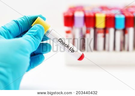 Test tube with blood sample for health checkup