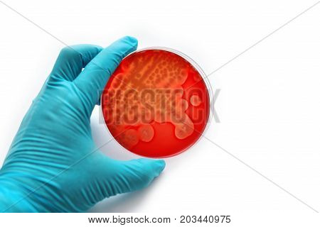 Colonies of bacteria in petri dish, white background