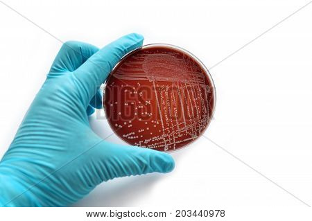 Colonies of bacteria in petri dish, white background