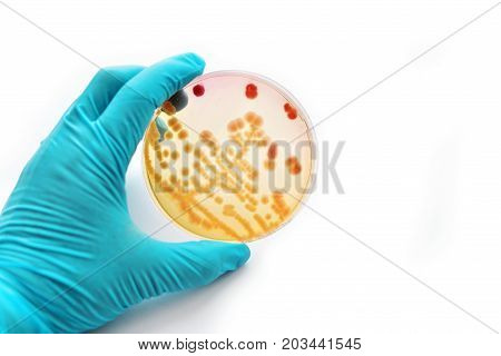Colonies of bacteria in petri dish (MacConkey agar)