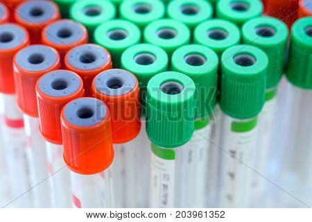 Group of medical sample tube, sample tube of blood for in the lab to diagnose the patient's disease, Green tube is prevent the hardening of blood, Red tube is helps accelerate the hardening of blood