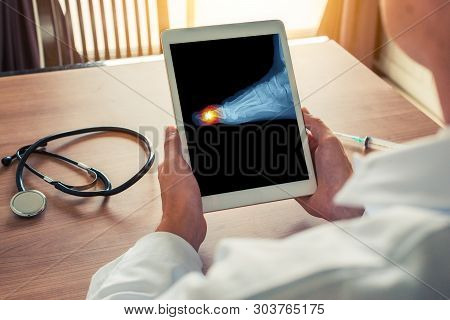 Doctor Holding A Digital Tablet With X-ray. Pain On The Toe Of The Foot.